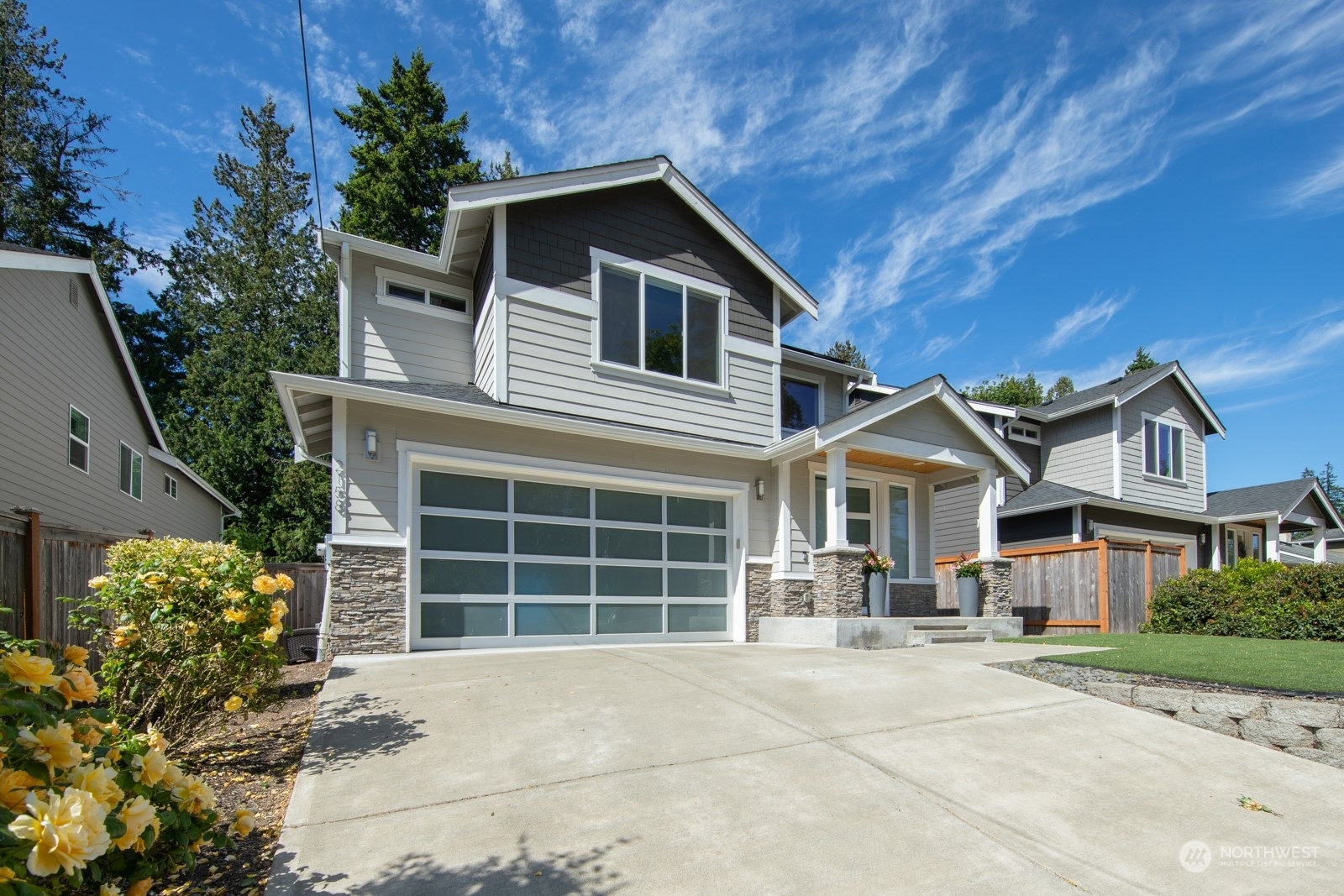 Property Photo: 2158 N 178th Street WA 98133